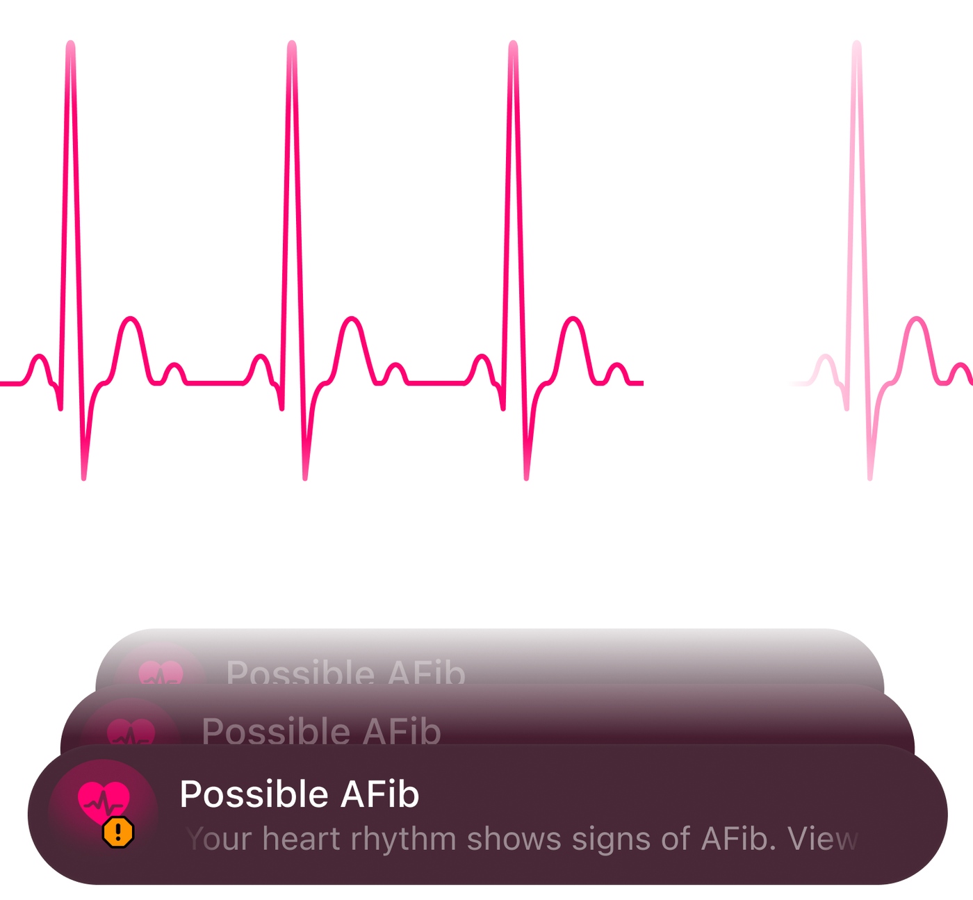Ultrahuman’s AFib feature flags readings that show possible signs of atrial fibrillation